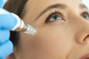 Microneedling with PRP Reading, PA