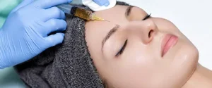 Platelet-Rich Fibrin Matrix (PRFM) vs Platelet-Rich Plasma (PRP) - Advanced Microneedling
