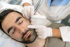 RF Microneedling Treatment in Reading, PA RF Microneedling Treatment in Reading, PA