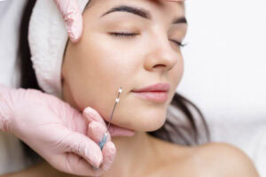 PDO Threads Pottstown, PA